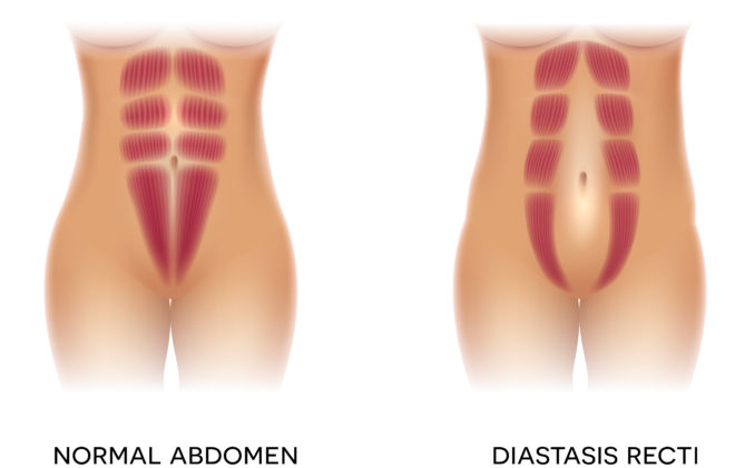 Diastase